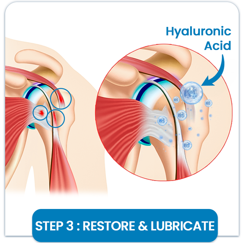 KUBOZN® Joint Pain & Inflammation Relief Microdarts Patch image KUBOZN® Joint Pain & Inflammation Relief Microdarts Patch