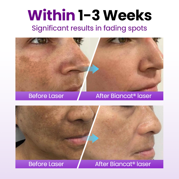 Cvreoz® SpotErase Probiotic Shield Serum 🅱︎