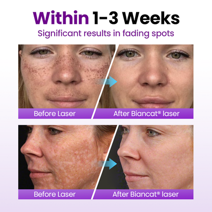 Cvreoz® SpotErase Probiotic Shield Serum 🅱︎