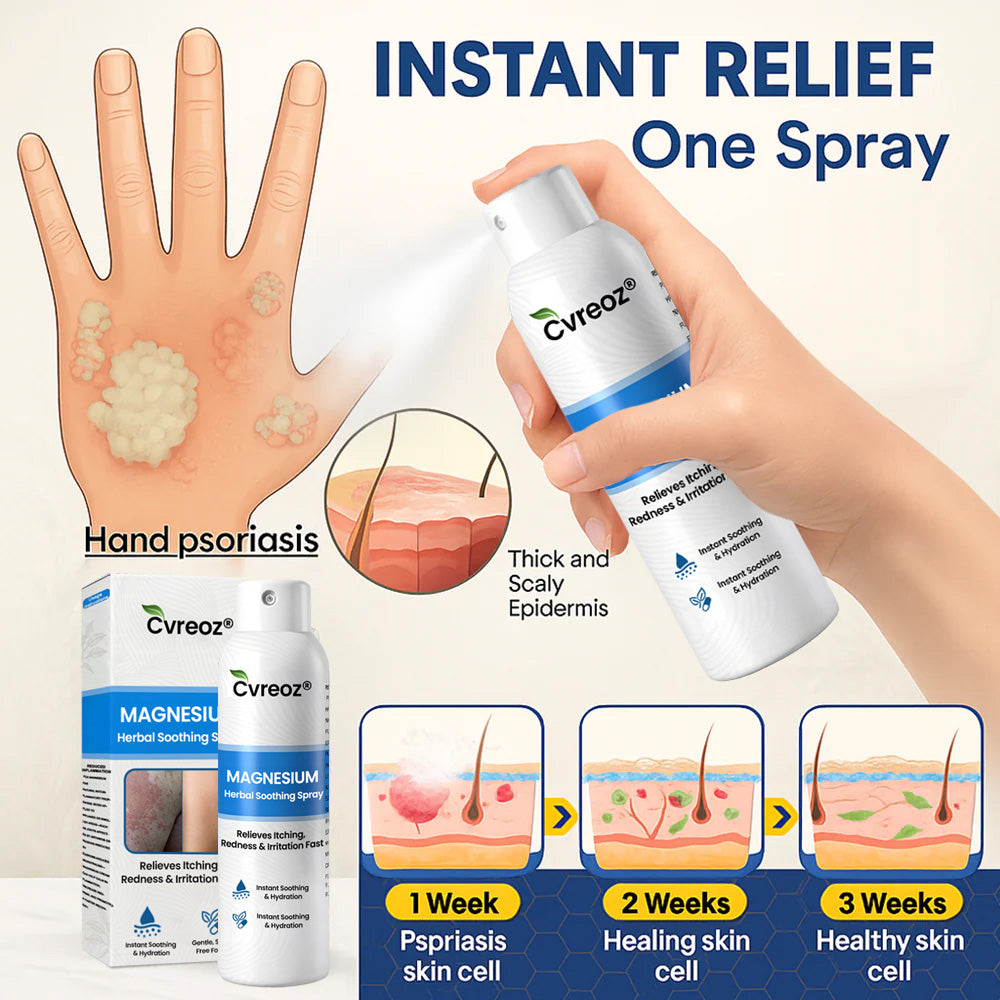 ✅ Official Store: Cvreoz® Magnesium Herbal Psoriasis & Eczema – Fast-Acting, Steroid-Free Relief