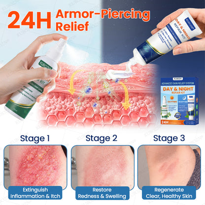 KUBOZN® Eczema Day & Night Repair System - 100% Steroid-Free Relief Duo for Intense Itch, Redness & Broken Skin (offer)
