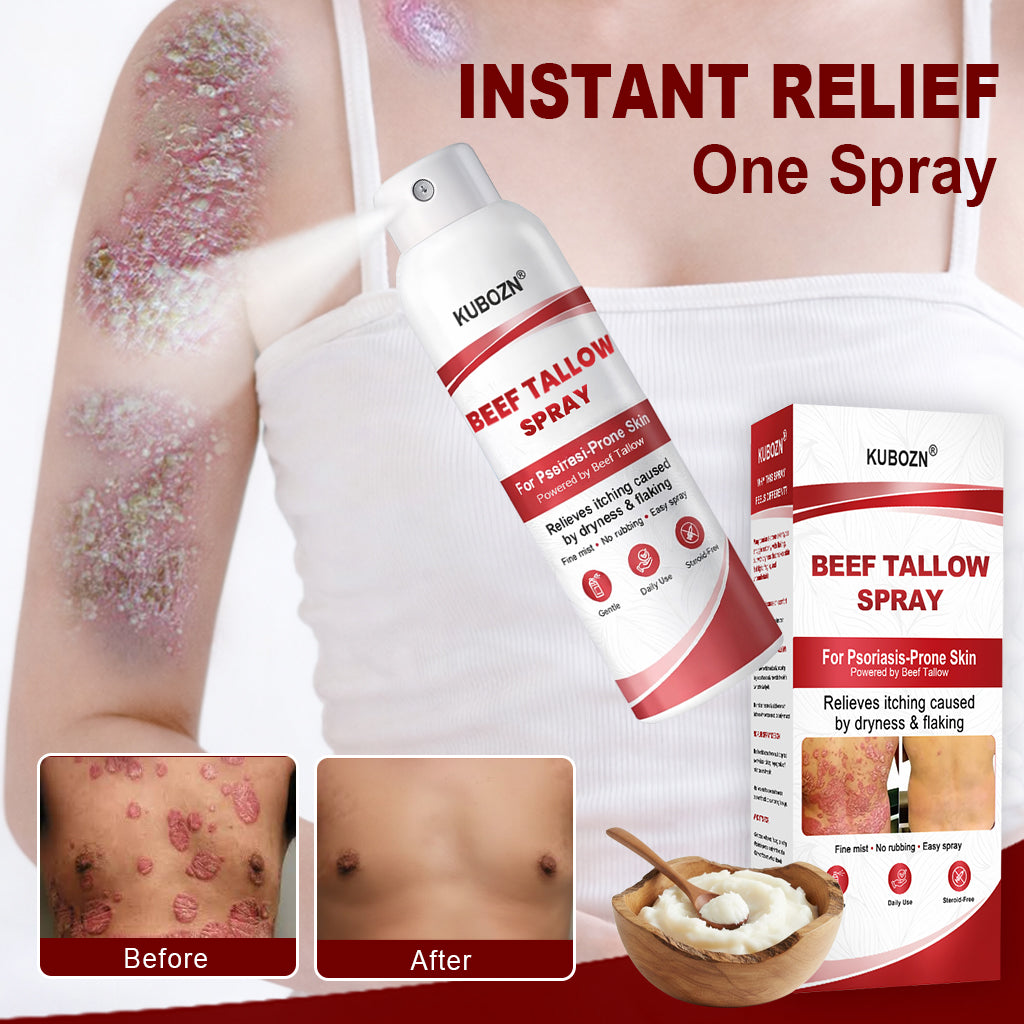 KUBOZN® Beef Tallow Spray — The No-Rub Relief for Psoriasis-Prone Skin✨ (Offer)