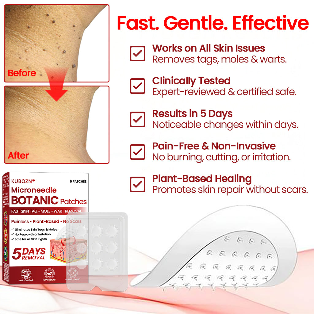🔥 2025 New Formula ⚡KUBOZN® Microneedle Skin Tag Removal Patches – Visible Results in 5 Days 🅱︎