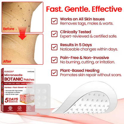 🔥 2025 New Formula ⚡KUBOZN® Microneedle Skin Tag Removal Patches – Visible Results in 5 Days 🅱︎