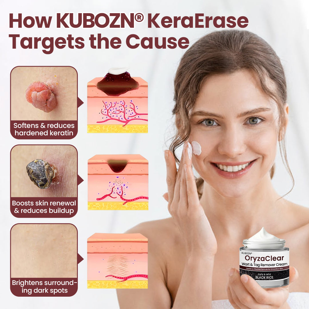 ✨KUBOZN® OryzaClear – Black Rice Softening Cream · Botanical Care for Skin Tags & Uneven Texture 🅱︎