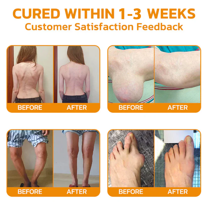 🇬🇧🥇 KUBOZN® MagniVen Joint Comfort Spray — Fast-Acting Ease & 4-Week Support