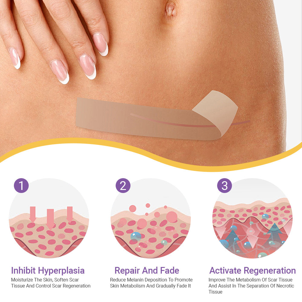 🪡 Cvreoz® Nano Microneedle Repair Tape — When Scar Creams Don’t Work 🅱︎