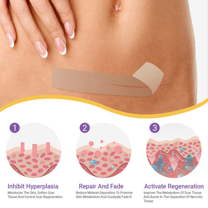 🪡 Cvreoz® Nano Microneedle Repair Tape — When Scar Creams Don’t Work 🅱︎