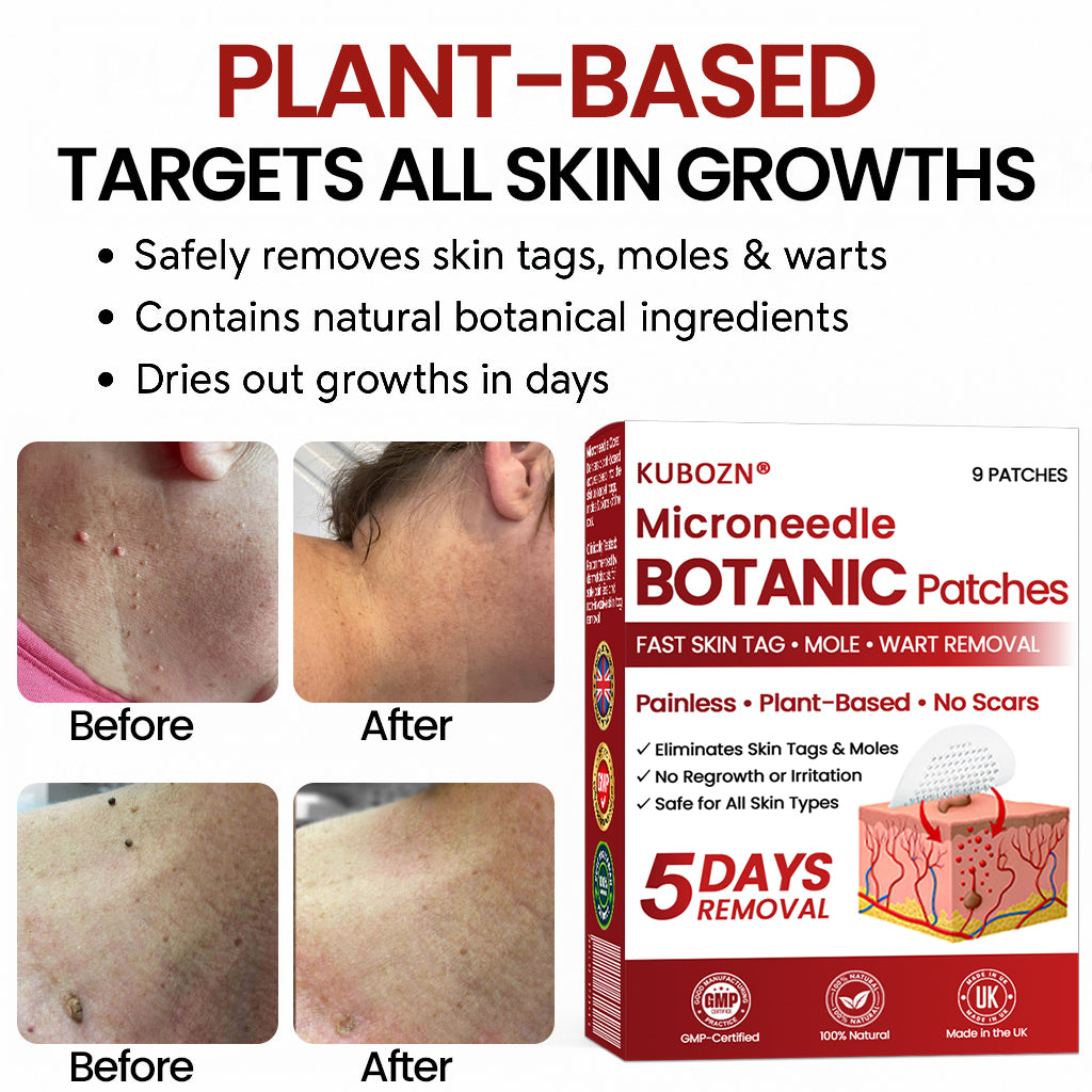 🔥 2025 New Formula ⚡KUBOZN® Microneedle Skin Tag Removal Patches – Visible Results in 5 Days 🅱︎