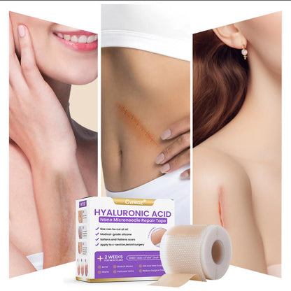 🪡 Cvreoz® Nano Microneedle Repair Tape — When Scar Creams Don’t Work 🅱︎
