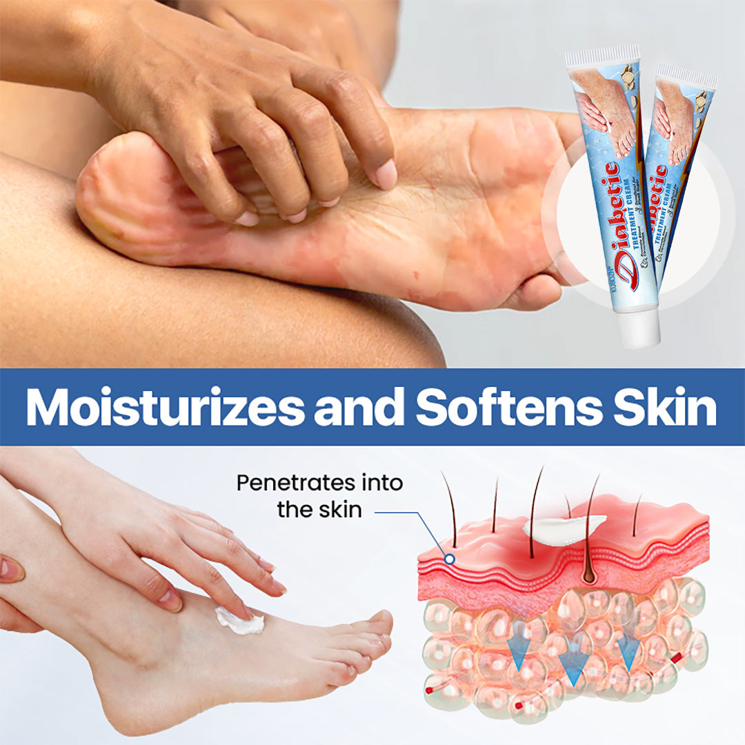 KUBOZN®VitaGluco Diabetes Treatment Cream -👨‍⚕️Dermatologist-Recommended Formula