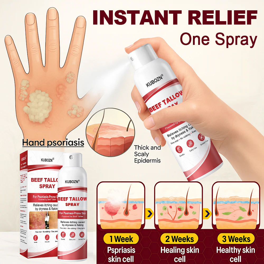 KUBOZN® Beef Tallow Spray — The No-Rub Relief for Psoriasis-Prone Skin✨ (Offer)