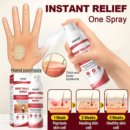 KUBOZN® Beef Tallow Spray — The No-Rub Relief for Psoriasis-Prone Skin✨ (Offer)