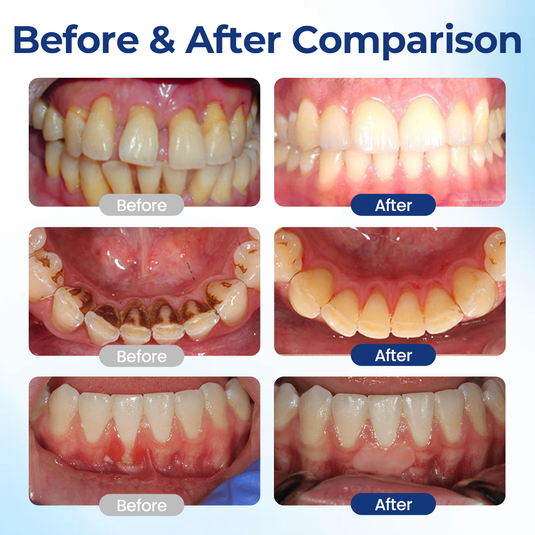 KUBOZN® BeeTakt Oral+ GUM REPAIR