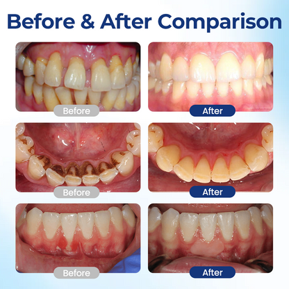 KUBOZN® BeeTakt Oral+ GUM REPAIR