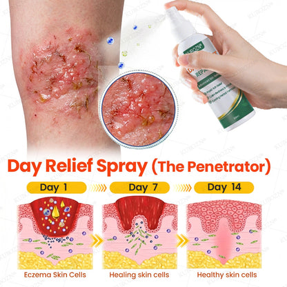 KUBOZN® Eczema Day & Night Repair System - 100% Steroid-Free Relief Duo for Intense Itch, Redness & Broken Skin (offer)