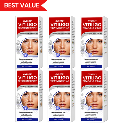 Cvreoz®Vitiligo Treatment Spray (offer)