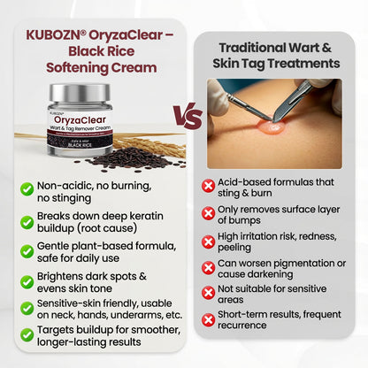 🎁KUBOZN® OryzaClear – Black Rice Softening Cream