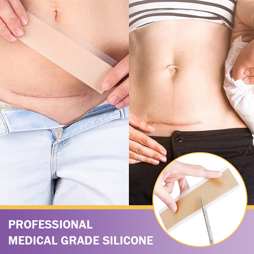 🪡 Cvreoz® Nano Microneedle Repair Tape — When Scar Creams Don’t Work 🅱︎