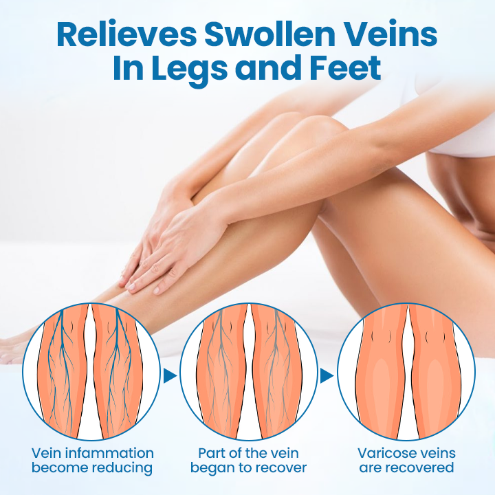 Cvreoz® VeinGuard Herbal Spray 🅱︎