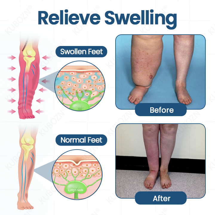 KUBOZN® Roll-On Cream for Lymphatic Drainage & Swelling Relief（offer）