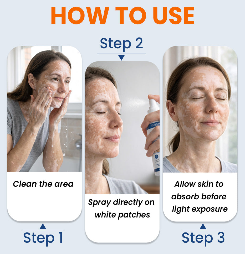 ⚡KUBOZN® Piperine Repigment Activator Spray to Reactivate Dormant Pigment Cells & Restore Natural Skin Color (Offer)