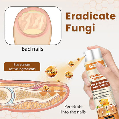 Cvreoz® Bee Venom Nail Fungus Spray (offer)