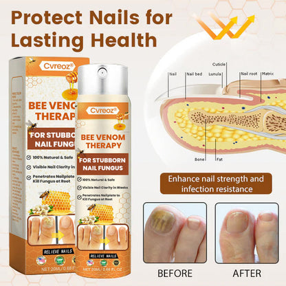 Cvreoz® Bee Venom Nail Fungus Spray (offer)
