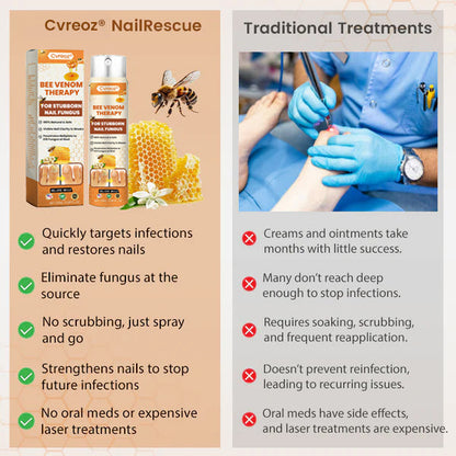 Cvreoz® Bee Venom Nail Fungus Spray (offer)